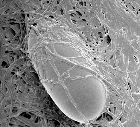 Pochonia chlamydosporia colonizando huevo de Meloidogyne