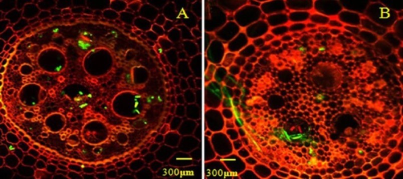 Estructuras de fusarium en endodermis y tejidos vasculares de banano