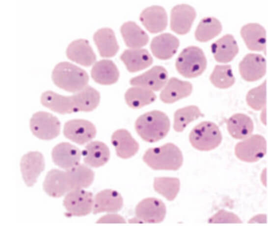 Eritrocitos infectados con Anaplasma Marginale con colorante de Giemsa