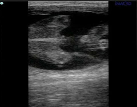 Determinación del sexo fetal en bovino por medio de ultrasonografía