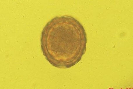 Huevo de Ascaris suum (Portal Veterinario, 2017).